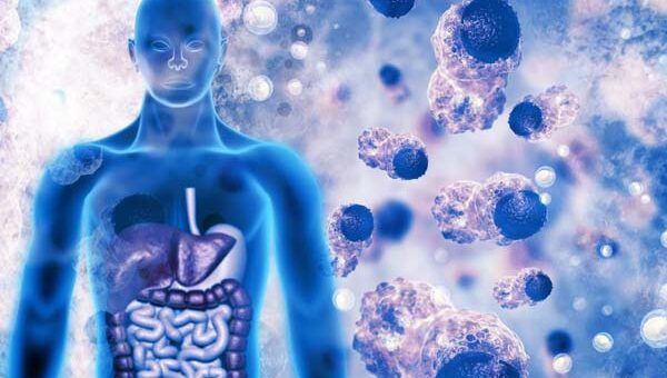 Cancer From Ranitidine Use