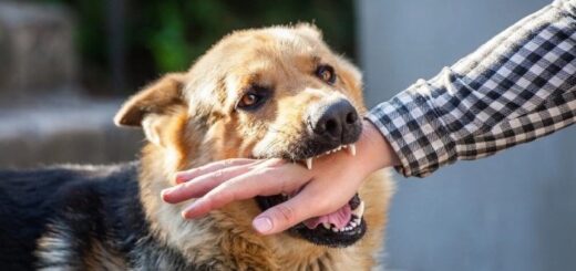 What To Do After a Dog Bite